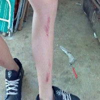 Side Shin